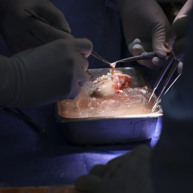 Surgeons prepare the pig kidney for transplantation
