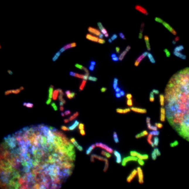Chromosomes prepared from a malignant glioblastoma visualized by spectral karyotyping (SKY) reveal an enormous degree of chromosomal instability -- a hallmark of cancer.