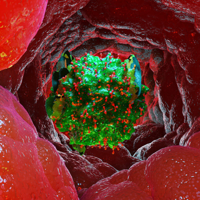 a green mast cell inside an organ — in the lab coverage from STAT