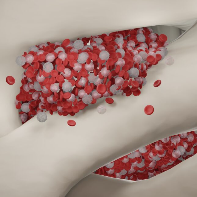 Bone marrow producing three clusters of blood cells — health coverage from STAT