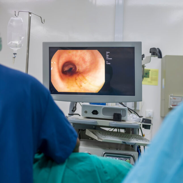 Colonoscopy displayed on a monitor in front of surgeons during a procedure — first opinion coverage from STAT