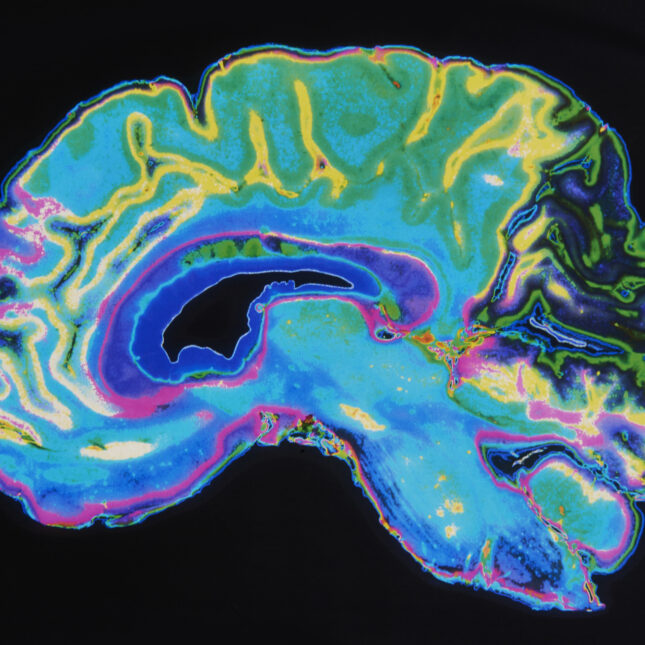 colorful brain MRI